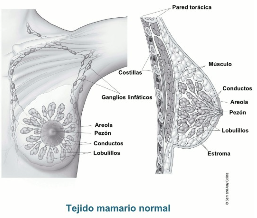 ganglios linfáticos supraclaviculares inflamados